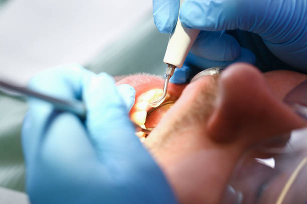 Best Same-Day Emergency Dental Services in New Lenox, IL