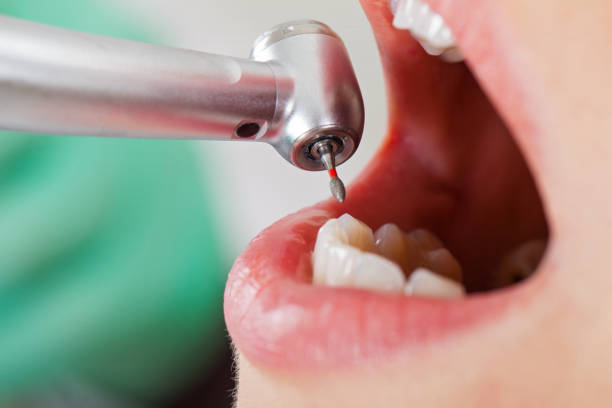 Best Emergency Gum Treatment in New Lenox, IL